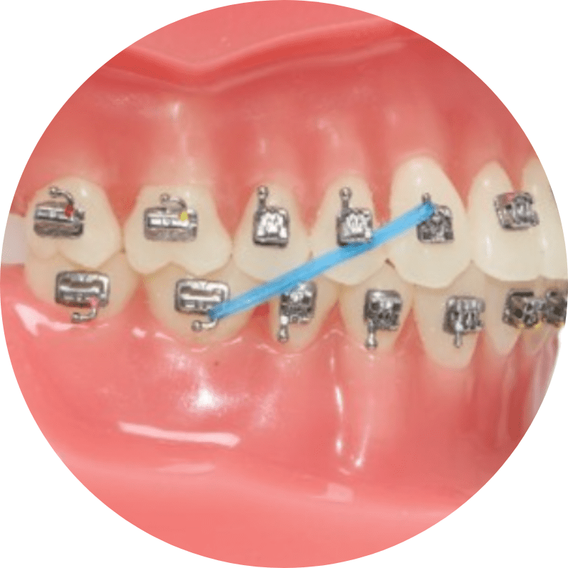 Elastics